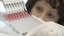KraussMaffei machines make an array of medical parts, including these pipettes.